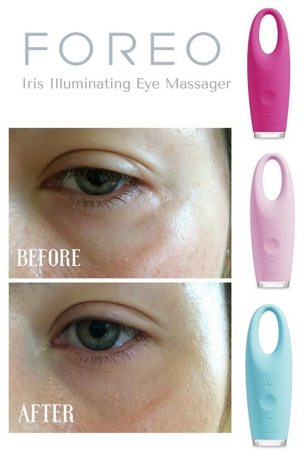 Review chi tiết máy massage mắt Foreo Iris xóa tan vết nhăn và bọng mắt - 5