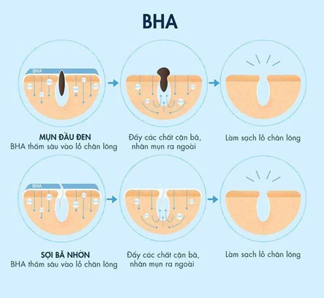 Cách dùng BHA Obagi hiệu quả trong quy trình chăm sóc da dầu mụn-11