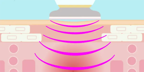 Máy Chăm Sóc Và Nâng Cơ Cho Da Mặt Yaman HRF-24R - Máy massage - Vua Hàng Hiệu