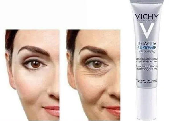 Kem Dưỡng Mắt Hỗ Trợ Giảm Nhăn, Giảm Quầng Thâm Vichy Liftactiv Supreme Eyes 15ml