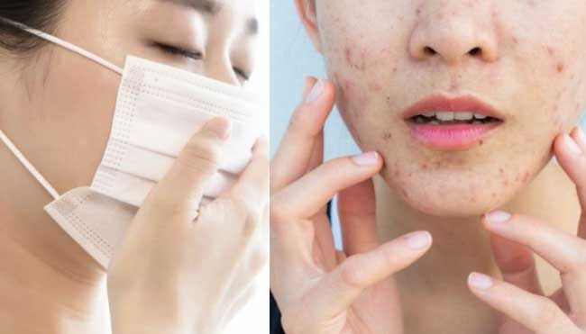 6 mẹo chăm sóc da mặt khi đeo khẩu trang thường xuyên - 1