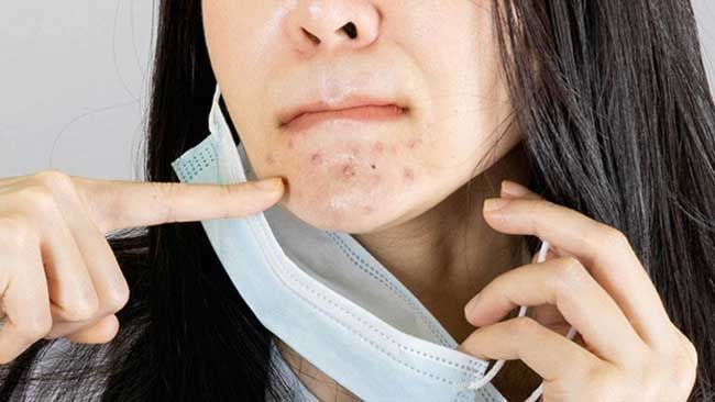 6 mẹo chăm sóc da mặt khi đeo khẩu trang thường xuyên - 2