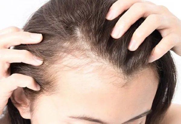 Review 7 dầu gội trị rụng tóc hiệu quả kích thích mọc tóc nhanh nhất - 4