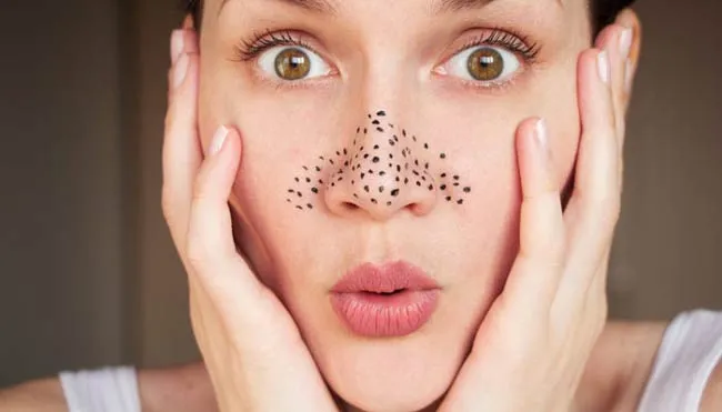 15 cách hỗ trợ làm sạch mụn đầu đen tại nhà từ nguyên liệu thiên nhiên 1