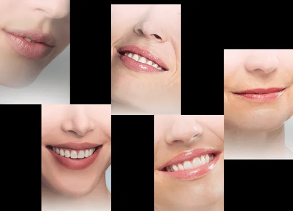 Son Dưỡng Làm Căng Đầy Môi Teoxane 3D Lip 10ml