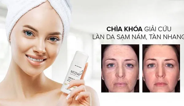 Kem Hỗ Trợ Giảm Nám Và Làm Trắng Da Neova Complex HQ+/ Hydroquinone 4% Rx Only 56g