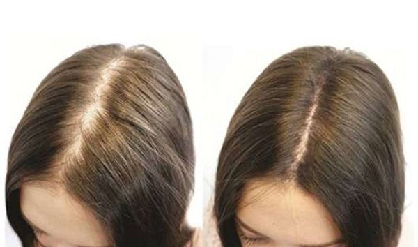 8 mẹo dưỡng tóc bằng dầu dừa giúp tóc dài nhanh và suôn mượt 2