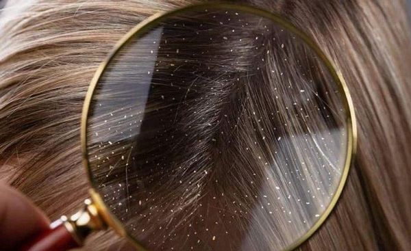 8 mẹo dưỡng tóc bằng dầu dừa giúp tóc dài nhanh và suôn mượt 3