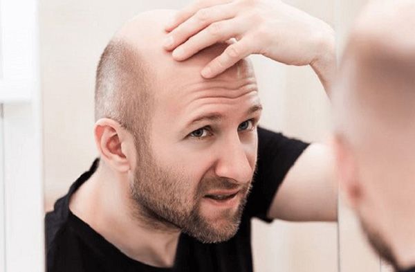 Top 12 cách làm dày tóc cho nam nhanh nhất không cần dùng thuốc