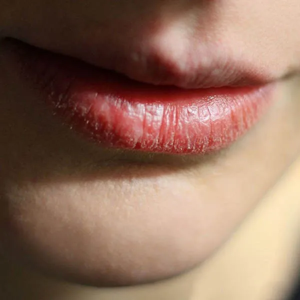 Son Dưỡng Chống Nắng Bảo Vệ Đôi Môi iS Clinical Lip Protect SPF 35 5g