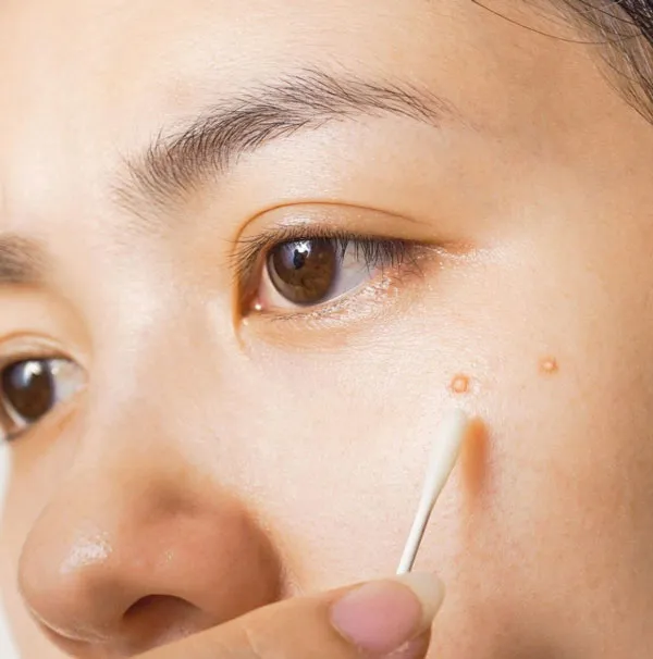 Top 11 kem chấm mụn hiệu quả nhanh được tin dùng nhất