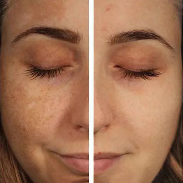 Tinh Chất Hỗ Trợ Giảm Thâm Nám, Tàn Nhang Eucerin Anti-pigment Spot Corrector 5ml - Mỹ phẩm - Vua Hàng Hiệu