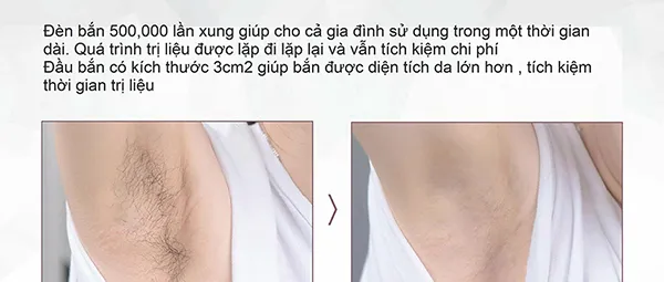 Máy Triệt Lông NanoTime Beauty Trẻ Hoá Da Công Nghệ IPL, Hiệu Suất Cao Super Photon NanoTime B62F