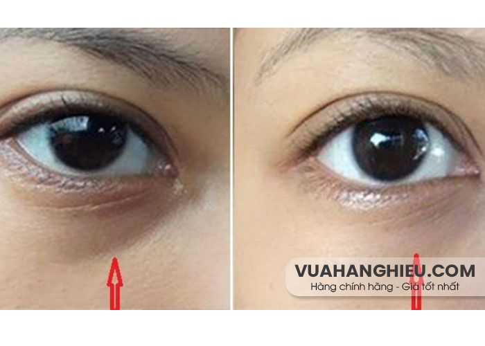 Review Kem mắt Estee Lauder Advanced Night Repair Eye có hiệu quả? - 6