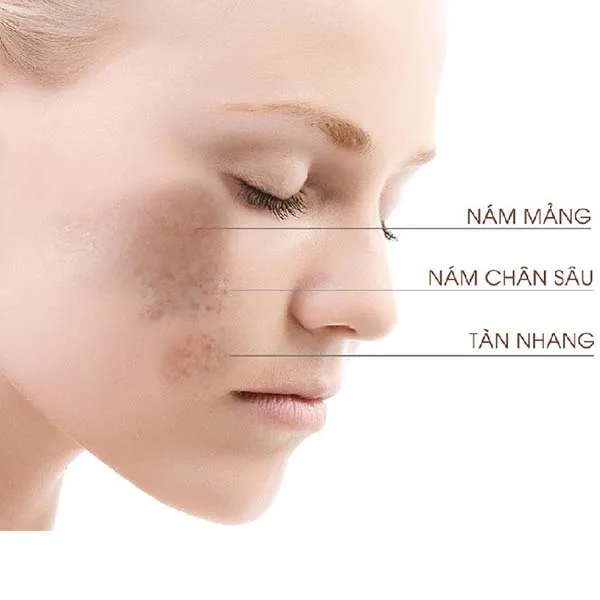 Kem Dưỡng Trắng Da SkinClinic Melanyc Daily Hỗ Trợ Giảm Thâm Nám 50ml
