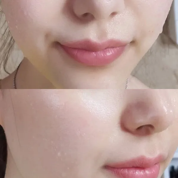 Dung Dịch Hỗ Trợ Làm Giảm Nám, Tàn Nhang Biologique Recherche Lotion P50 PIGM 400 500ml - Mỹ phẩm - Vua Hàng Hiệu
