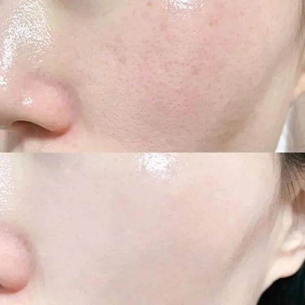 Toner GlamGlow Supertoner Exfoliating Acid Solution Sáng Da 200ml - Mỹ phẩm - Vua Hàng Hiệu