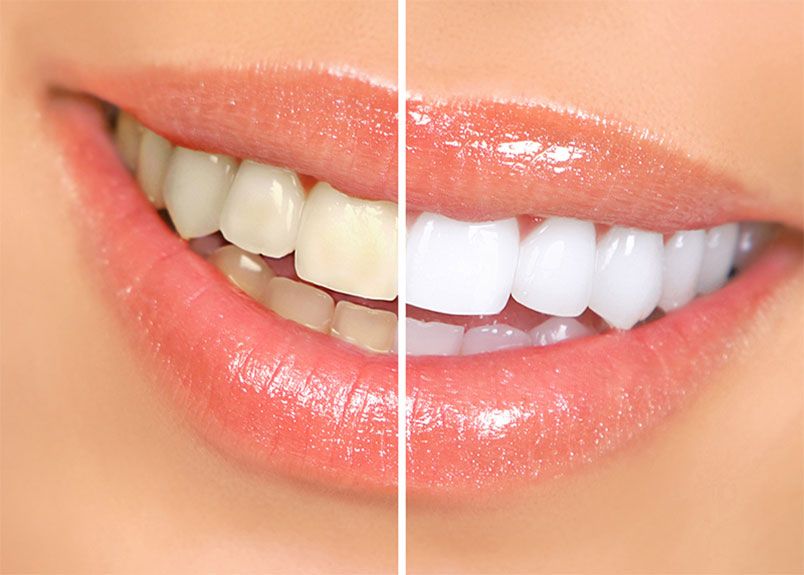 11 cách chăm sóc răng miệng đúng cách bảo vệ răng chắc khỏe -12