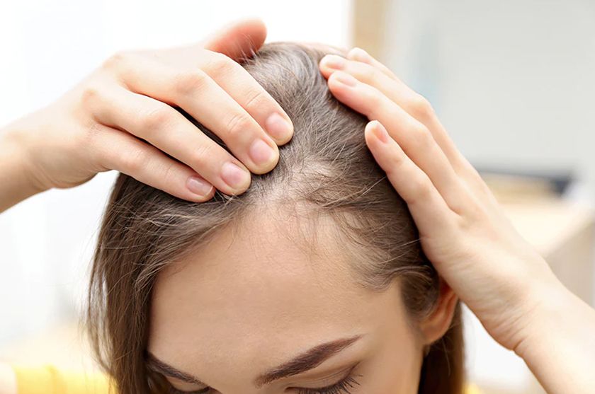 Rụng tóc sau sinh là gì? 13 cách ngăn ngừa tóc rụng cho mẹ bỉm sữa-2