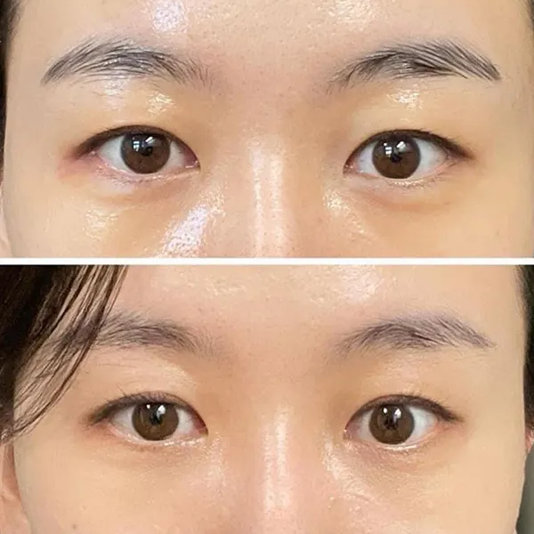 Kem Dưỡng Hỗ Trợ Ngăn Ngừa Nếp Nhăn Mắt Nescens Gel Emulsion Eye Contour Area 15ml - Mỹ phẩm - Vua Hàng Hiệu