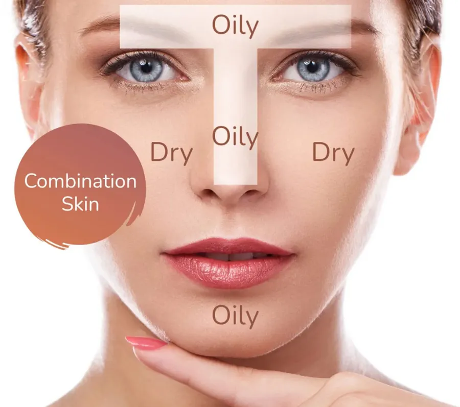 Đặc điểm của làn da hỗn hợp thiên khô
