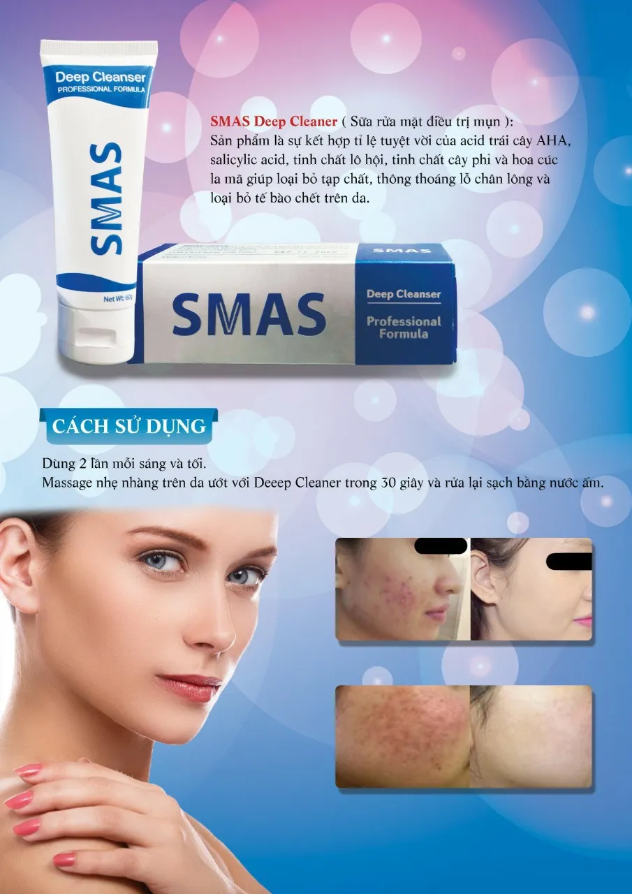 Sữa rửa mặt Smas