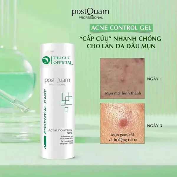 Gel Dưỡng Hỗ Trợ Giảm Mụn postQuam Acne Control 50ml