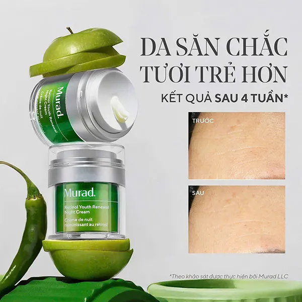 Kem Dưỡng Da Ban Đêm Hỗ Trợ Dưỡng Ẩm Và Làm Mờ Nếp Nhăn Murad Retinol Youth Renewal Night Cream 50ml