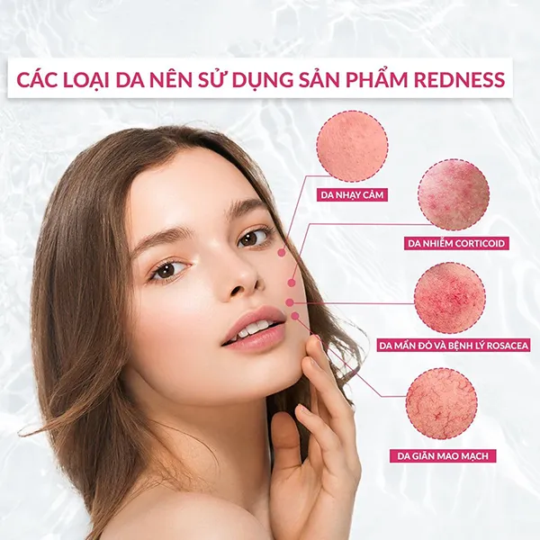 Kem Dưỡng Phục Hồi Da Mẩn Đỏ Nhạy Cảm Dermedic Rosacea Prone Skin Anti-Ageing Night Cream 40ml