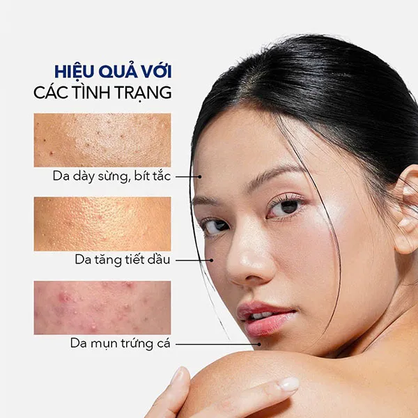 Nước Cân Bằng Da Image Skincare Clear Cell Salicylic Clarifying Tonic 118ml