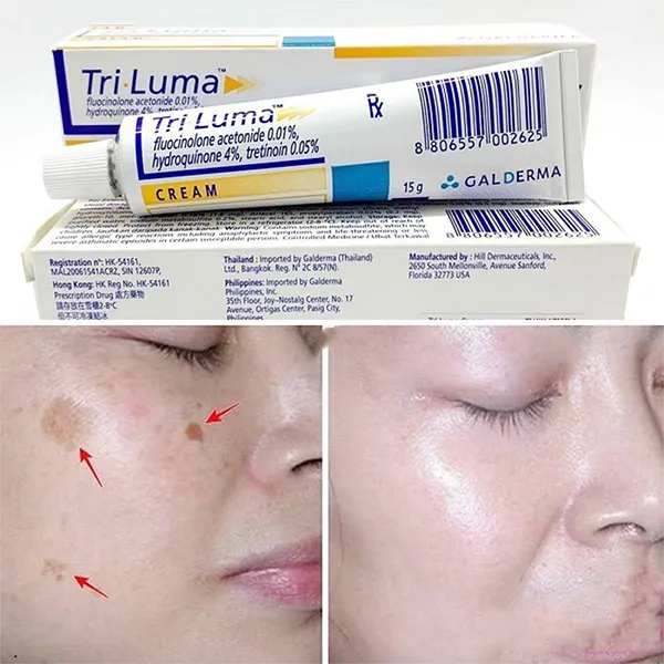 Kem Dưỡng Da Hỗ Trợ Làm Mờ Nám Galderma Tri Luma Cream 15g