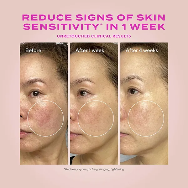 Tinh Chất Hỗ Trợ Tái Tạo Da Murad Heartleaf Gentle Resurfacing Serum 30ml