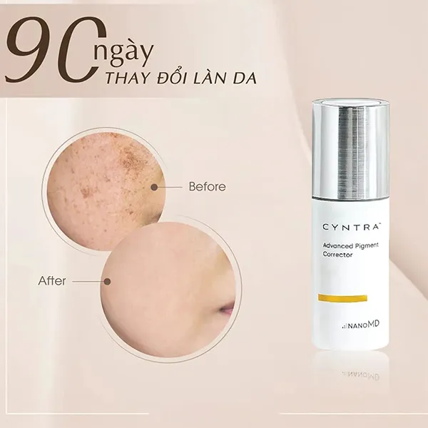 Kem Dưỡng Làm Mờ Nám NanoMD Cyntra Advanced Pigment Corrector 20ml