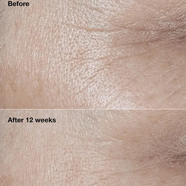 Kem Dưỡng Ngừa Lão Hóa Da Clinique Clinique Smart Clinical Repair™ Broad Spectrum SPF30 50ml
