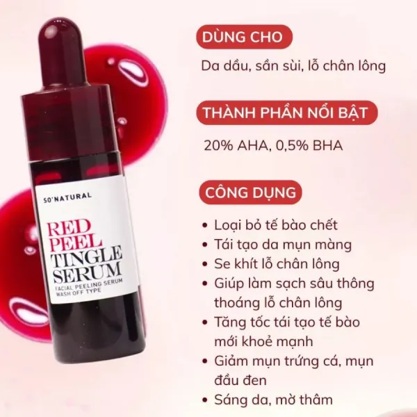 Tinh Chất Hỗ Trợ Tái Tạo Da Sinh Học So'Natural Red Peel Tingle Serum 11ml
