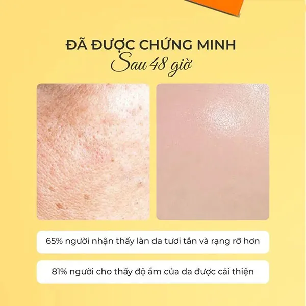 Tinh Chất Hỗ Trợ Chố.ng Oxy Hóa Và Làm Sáng Da Sesderma C-VIT 5 Liposomal Serum (30ml)