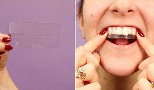 Miếng dán trắng răng có tốt không? Top 5 miếng dán trắng răng bán chạy nhất