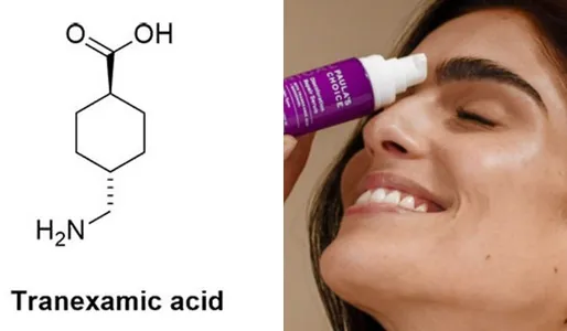 Tranexamic acid là gì? Công dụng của tranexamic acid với làn da