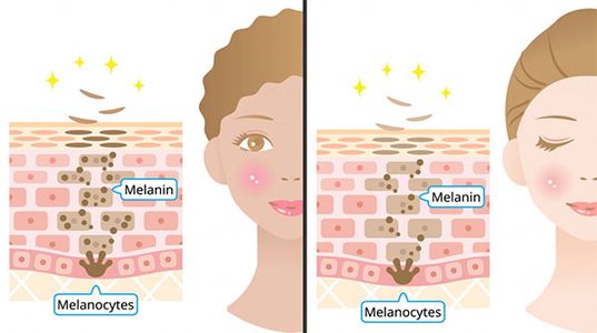 Melanin là gì? Lợi ích với làn da và những rối loạn liên quan